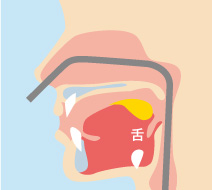 鼻からの胃内視鏡